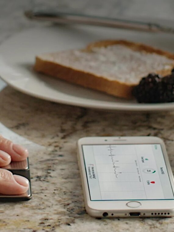 AliveCor KardiaMobile 6L Personal EKG Monitor, FDA-Cleared, Six-Lead, Smartphone Compatible, Detects AFib, Bradycardia, Tachycardia